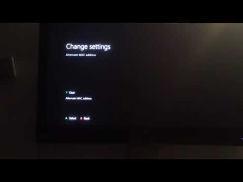 How to fix Xbox One Lag  tips of the day #howtofix #technology #today #viral #fix #technique