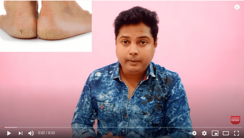 How To Get Rid of Cracked Heels | How To Fix Cracked Heels | Crack Heel Treatment in Bengali  tips of the day #howtofix #technology #today #viral #fix #technique